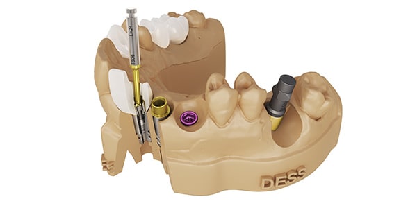 DESS Dental Smart Solutions®
