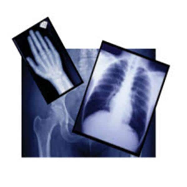 Radiomat MPlus X-Ray Film 100/Bx