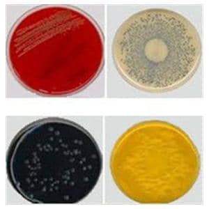 Culture TSA: Trypticase Soy Agar Spacesaver Plate 15/Pk