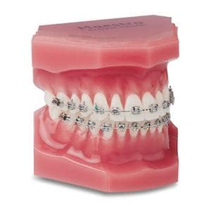 Maestro® Mini-Twin® MBT Rx Bracket .022 UR2 10T 8A 0O 10/Pk