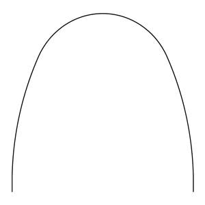 Bio-Kinetix Plus Archwire Etched Thermal Nitanium 0.016 in x 0.025 in Ea