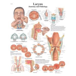 Larnyx 20x25" Anatomical Chart Ea