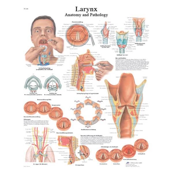 Larnyx 20x25" Anatomical Chart Ea