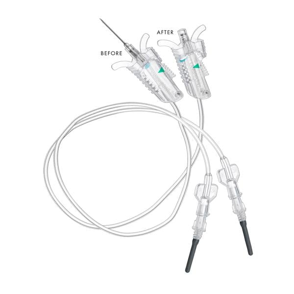 VanishPoint Blood Collection Set 21gx3/4" Dark Green Safety 12" Tubing 50/Bx