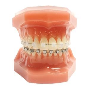 Carriere SLX 3D Typodont Ea