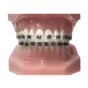 Carriere SLX 3D Typodont Ea