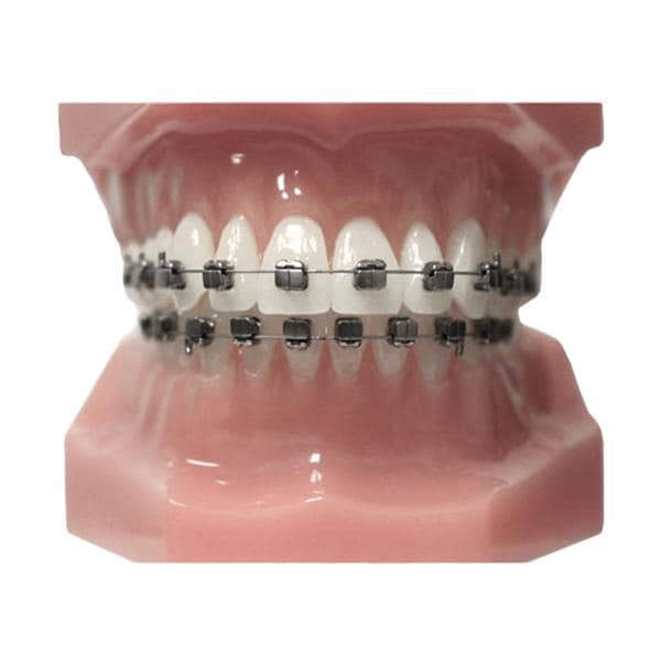 Carriere SLX 3D Typodont Ea