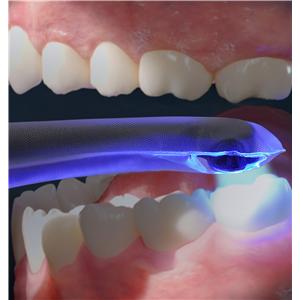 Curing Light Protective Sleeve 100/Bx