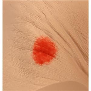 Seymour II Decubitus Wound Care Wound Care Geriatric Simulator Ea