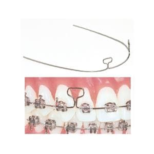 TruForce Archwire Retraction T-Loop Stainless Steel 0.019 in x 0.025 in 10/Pk