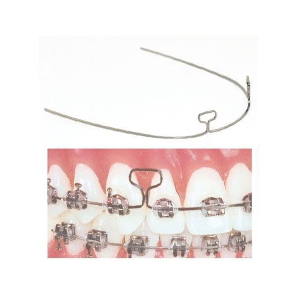 TruForce Archwire Retraction T-Loop Stainless Steel 0.019 in x 0.025 in 10/Pk