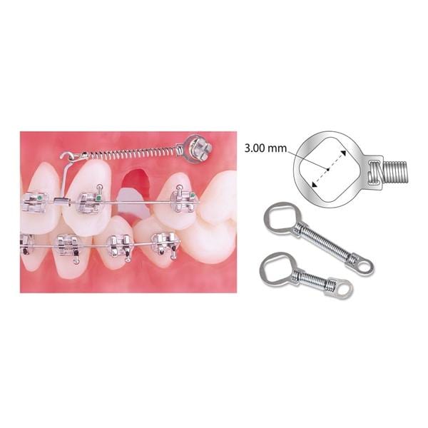 TruFlex TAD Coil Spring Light Force Closed NiTi 9 mm 0.009 in x 0.030 in 10Pk