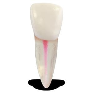 Real-T #8/Central Incisor/Maxillary Right Endo/Practice Tooth Ea