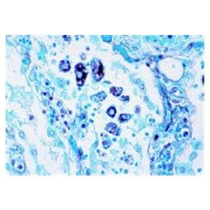 Silver Stain Methenamine/Borax Ea