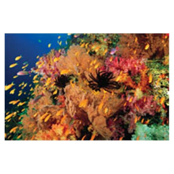 CeilingScenes Acoustic Tile Anties Fish 2-Tiles Vertical 24 in x 24 in Ea