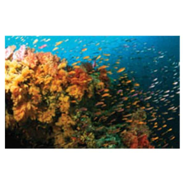CeilingScenes Light Lens Fiji Reef 2-Tiles Horizontal 24 in x 24 in Ea