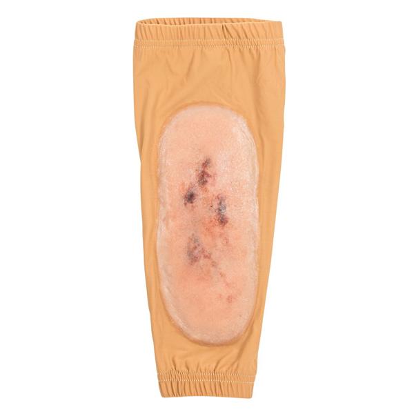 STOPS Medical Fracture Tibia Training Sleeve Ea