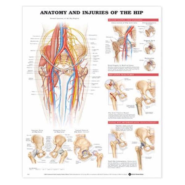 Anatomy and Injuries of the Hip 20x26" Anatomical Chart Ea