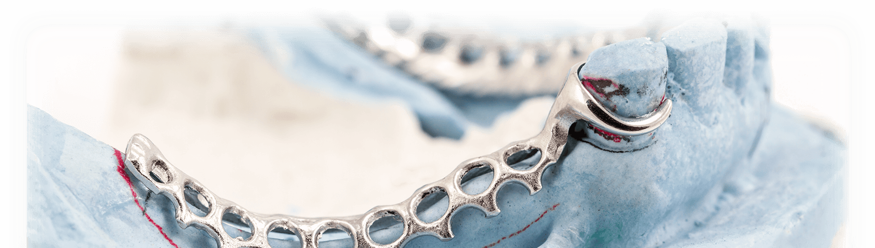 Attachments Zahn Dental Henry Schein