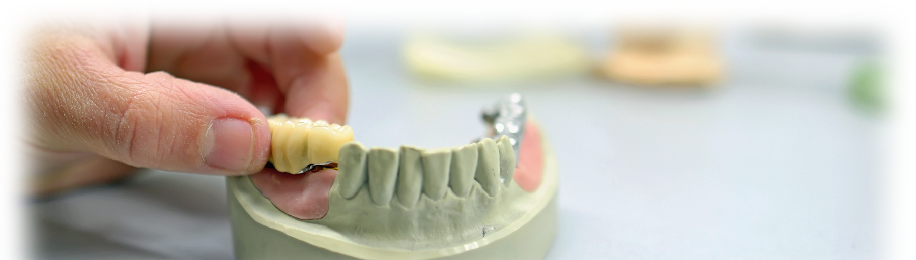 Dowel Pins Zahn Dental Henry Schein