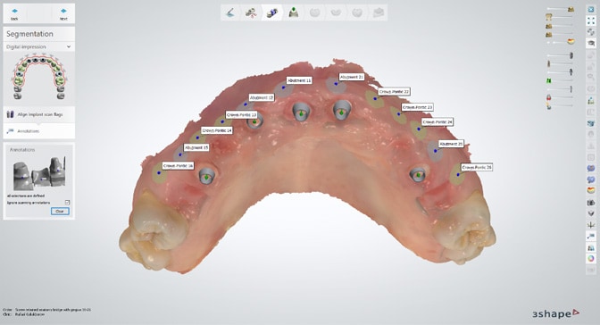 3Shape-Dental-System-2024_image-03