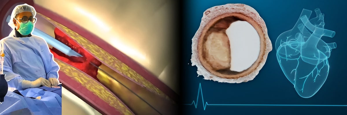 Register for Exclusive On-Demand Video Access